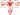 endometrial-polip